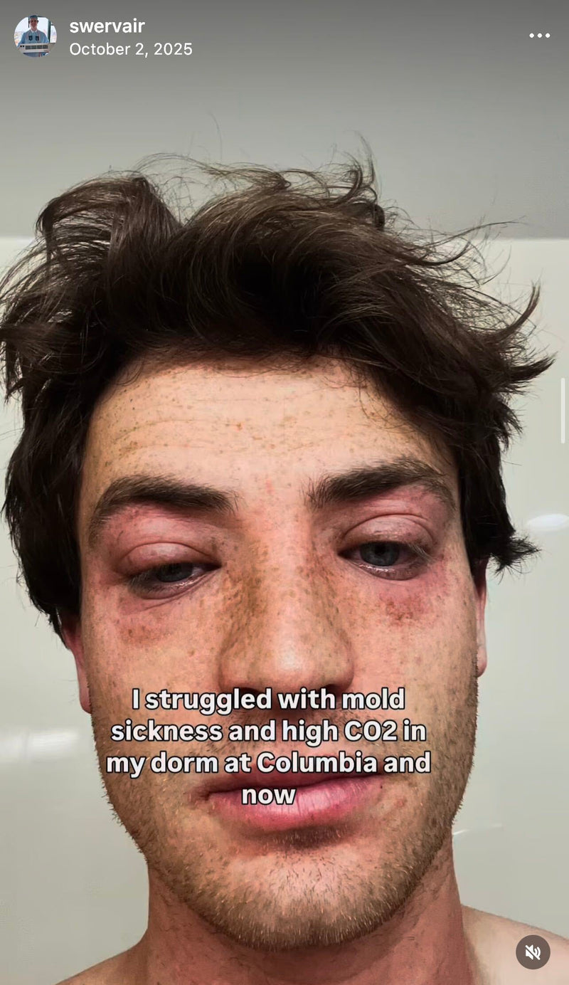 Austin Risenberger Founder of SWERV with visible skin conditions from mold sickness and text about mold sickness and high CO2 levels in a dorm room.